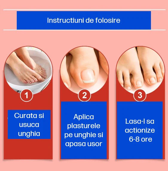 Plasturi antifungici & antibacterieni pentru unghii, tratament micoză/onicomicoză, acțiune 8h peste noapte, reparare și regenerare, 21 Buc